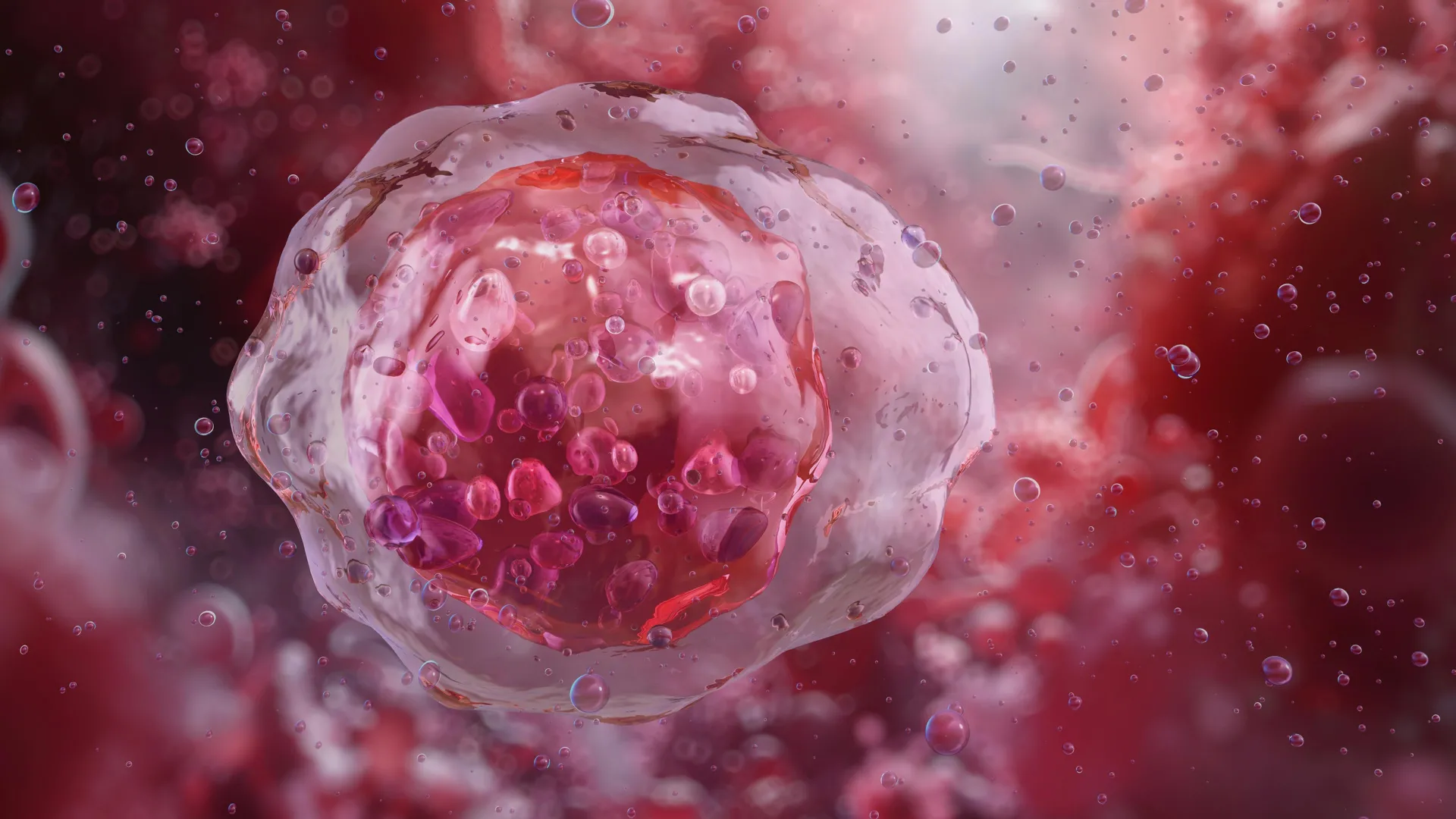 현미경으로 관찰한 골수아세포(Myeloblast)의 모습이다.