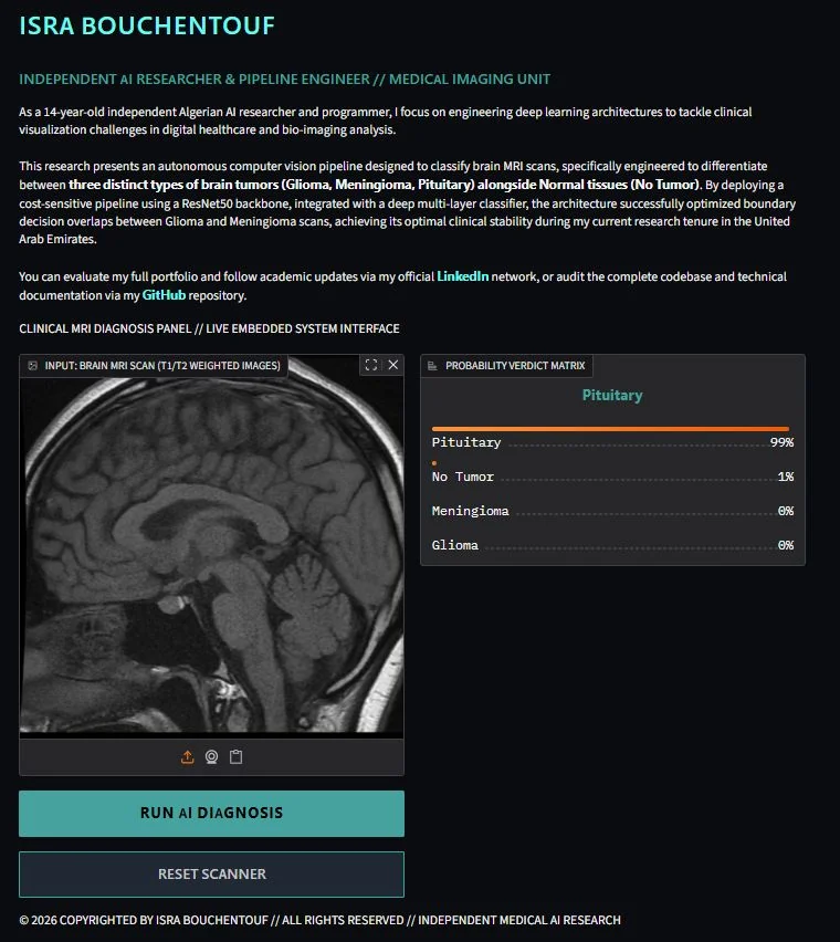 MRI 입력 패널과 우측의 확률 판정 행렬을 포함한 진단 인터페이스 스크린샷이다.
