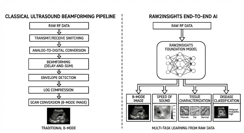 전통적인 초음파 빔포밍 파이프라인과 Raw2Insights 엔드투엔드 AI 파이프라인의 비교 다이어그램